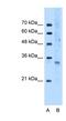 Forkhead Box I3 antibody, NBP1-79274, Novus Biologicals, Western Blot image 
