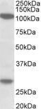 ADP-ribosylation factor 4 antibody, 43-074, ProSci, Western Blot image 