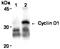 Cyclin D1 antibody, M00149-2, Boster Biological Technology, Immunoprecipitation image 