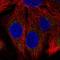 SH2B Adaptor Protein 1 antibody, HPA076175, Atlas Antibodies, Immunofluorescence image 