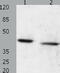 Gastrin Releasing Peptide Receptor antibody, TA321705, Origene, Western Blot image 