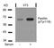 Paxillin antibody, GTX50155, GeneTex, Western Blot image 