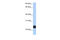 Transmembrane Protein 123 antibody, 26-495, ProSci, Enzyme Linked Immunosorbent Assay image 