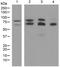ADAM Metallopeptidase Domain 10 antibody, ab124695, Abcam, Western Blot image 