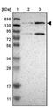 PEAK1 Related, Kinase-Activating Pseudokinase 1 antibody, NBP1-87473, Novus Biologicals, Western Blot image 