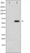 Cell Division Cycle 25B antibody, abx010540, Abbexa, Western Blot image 