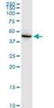 DSCC1 antibody, H00079075-B01P, Novus Biologicals, Western Blot image 