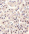 Glutamic--Pyruvic Transaminase antibody, MBS9207377, MyBioSource, Immunohistochemistry frozen image 