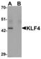 Kruppel Like Factor 4 antibody, LS-C144496, Lifespan Biosciences, Western Blot image 