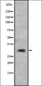 Calcium Voltage-Gated Channel Auxiliary Subunit Gamma 5 antibody, orb335098, Biorbyt, Western Blot image 