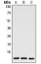 Caspase 7 antibody, LS-C351918, Lifespan Biosciences, Western Blot image 