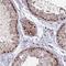 TRNA Methyltransferase 6 antibody, NBP2-13486, Novus Biologicals, Immunohistochemistry paraffin image 