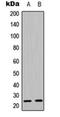 Caveolin 1 antibody, orb216046, Biorbyt, Western Blot image 