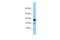 Interleukin 22 Receptor Subunit Alpha 2 antibody, ARP65578_P050, Aviva Systems Biology, Western Blot image 