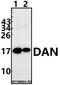 NBL1, DAN Family BMP Antagonist antibody, A07523T161, Boster Biological Technology, Western Blot image 