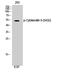 Keratin 8 antibody, STJ91078, St John