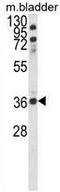 Favine antibody, GTX81055, GeneTex, Western Blot image 