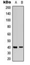 Mitogen-Activated Protein Kinase Kinase 3 antibody, LS-C368409, Lifespan Biosciences, Western Blot image 