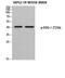 Sphingosine-1-Phosphate Receptor 1 antibody, STJ91353, St John