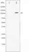 Signal Transducer And Activator Of Transcription 2 antibody, abx011823, Abbexa, Western Blot image 