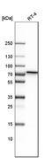 Polypeptide N-Acetylgalactosaminyltransferase 1 antibody, HPA012628, Atlas Antibodies, Western Blot image 