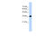 Canopy FGF Signaling Regulator 3 antibody, 28-087, ProSci, Western Blot image 