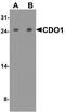 Cysteine Dioxygenase Type 1 antibody, A05016, Boster Biological Technology, Western Blot image 