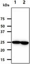 Nicotinamide N-Methyltransferase antibody, GTX57647, GeneTex, Western Blot image 