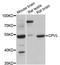Carboxypeptidase Vitellogenic Like antibody, LS-C747478, Lifespan Biosciences, Western Blot image 