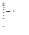 SWI/SNF Related, Matrix Associated, Actin Dependent Regulator Of Chromatin, Subfamily B, Member 1 antibody, STJ98643, St John