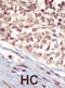 EPH Receptor A5 antibody, abx033519, Abbexa, Immunohistochemistry paraffin image 
