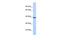 Potassium Two Pore Domain Channel Subfamily K Member 1 antibody, PA5-41010, Invitrogen Antibodies, Western Blot image 