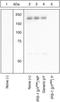 Insulin Receptor Substrate 1 antibody, GTX24873, GeneTex, Western Blot image 