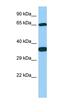 Polypeptide N-Acetylgalactosaminyltransferase 13 antibody, orb325563, Biorbyt, Western Blot image 