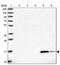 Retinol Binding Protein 5 antibody, PA5-58515, Invitrogen Antibodies, Western Blot image 