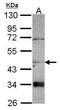 Carnosine Dipeptidase 2 antibody, PA5-30694, Invitrogen Antibodies, Western Blot image 
