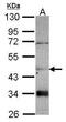 Carnosine Dipeptidase 2 antibody, PA5-30694, Invitrogen Antibodies, Western Blot image 