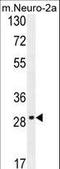 Olfactory Receptor Family 9 Subfamily Q Member 1 antibody, LS-C163263, Lifespan Biosciences, Western Blot image 