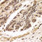 Tryptophanase antibody, LS-C334932, Lifespan Biosciences, Immunohistochemistry paraffin image 