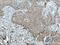 Tropomyosin 2 antibody, 55443-1-AP, Proteintech Group, Immunohistochemistry frozen image 