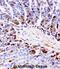Protein Kinase C Beta antibody, abx028235, Abbexa, Immunohistochemistry paraffin image 
