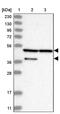 Inositol Polyphosphate-5-Phosphatase K antibody, PA5-56622, Invitrogen Antibodies, Western Blot image 