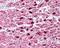 Peroxisome Proliferator Activated Receptor Gamma antibody, 49-549, ProSci, Immunohistochemistry frozen image 