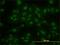 Kruppel Like Factor 11 antibody, H00008462-M01, Novus Biologicals, Immunocytochemistry image 