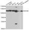 Minichromosome Maintenance Complex Component 6 antibody, A1955, ABclonal Technology, Western Blot image 