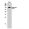 Tumor Protein P73 antibody, LS-C380595, Lifespan Biosciences, Western Blot image 