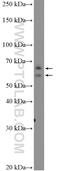 Deltex E3 Ubiquitin Ligase 1 antibody, 18350-1-AP, Proteintech Group, Western Blot image 
