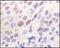 Lysine Acetyltransferase 8 antibody, 32-197, ProSci, Immunohistochemistry paraffin image 