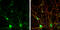 Choline O-Acetyltransferase antibody, GTX113164, GeneTex, Immunofluorescence image 