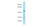 Tubulin Tyrosine Ligase Like 3 antibody, A11845, Boster Biological Technology, Western Blot image 